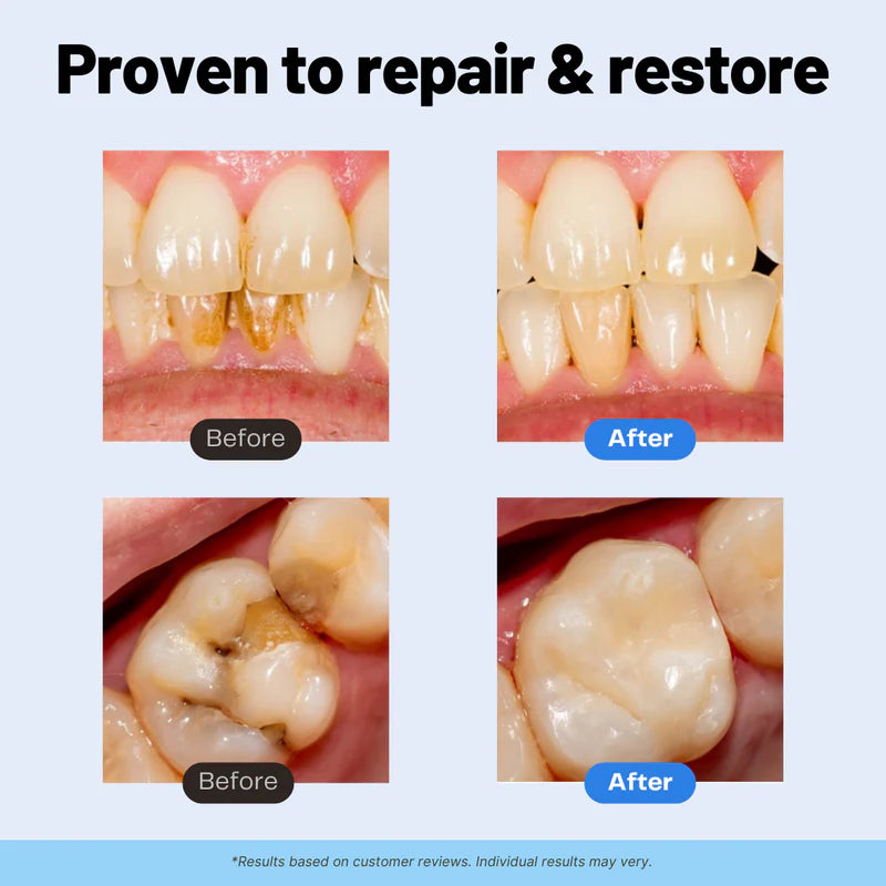 LAST DAY: Buy 1, Get 1 FREE — Glavering™ Remineralizing Repair+ Toothpaste